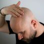 Better Be Bold Magic Bald Head & Beard Oil